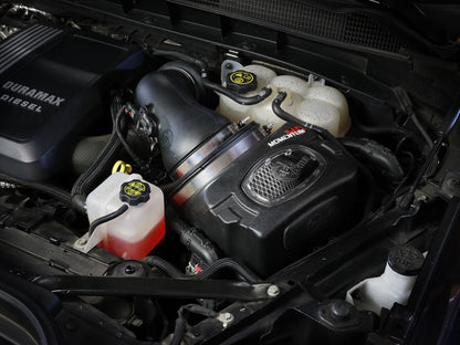 Momentum HD Cold Air Intake System w/ Pro Dry S Filter GM Trucks/SUVs 20-26 L6-3.0L (td) LM2/LZ0 aFe Power-5