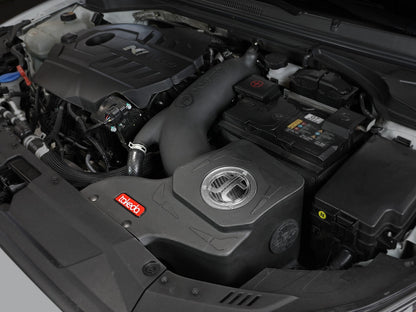 Takeda Momentum Cold Air Intake System w/ Pro Dry S Filter Hyundai i30 N 17-26 L4-2.0L (t) aFe Power-6