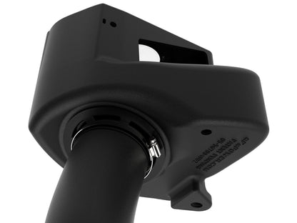 Takeda Momentum Cold Air Intake System w/ Pro Dry S Filter Subaru Forester 14-18 H4-2.0L (t) aFe Power-5